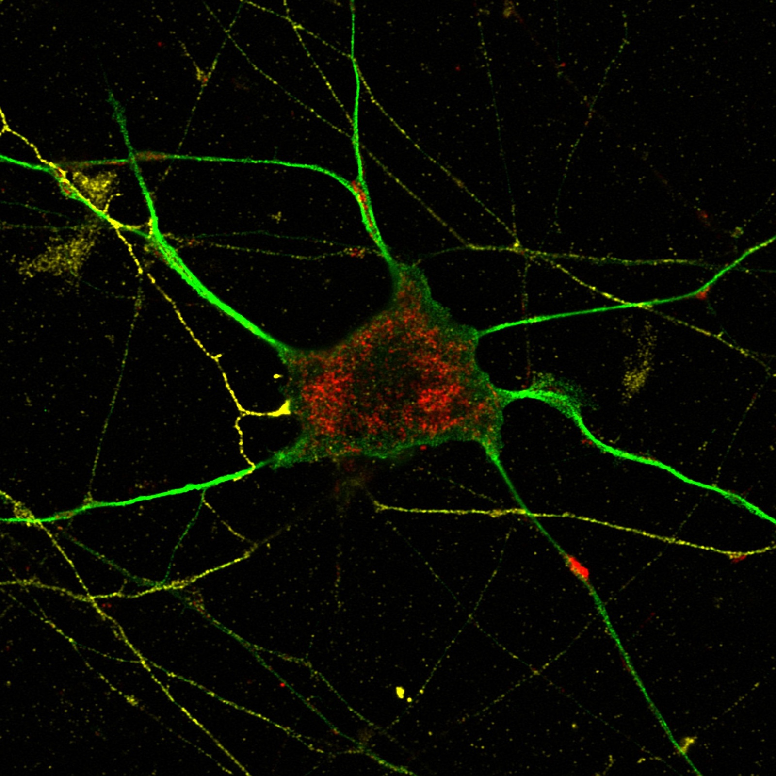 Confocal microscopy image of a cultured neuron immunolabeled to show mitochondria and lysosomes